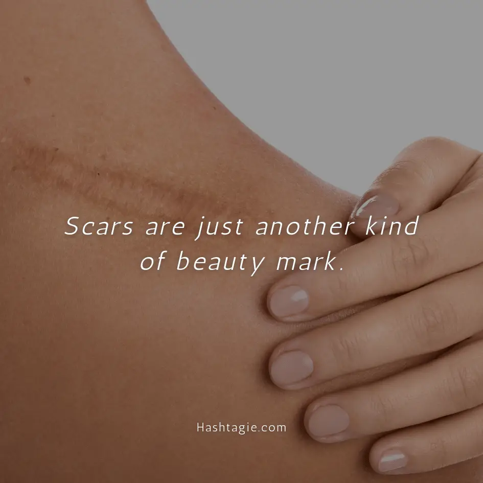 Body positive captions for disability acceptance  example image