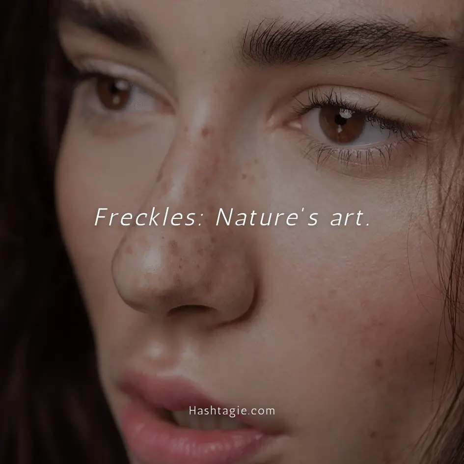 Body positive captions for freckle appreciation  example image