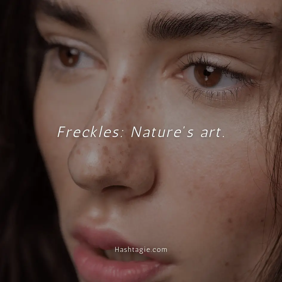 Body positive captions for freckle appreciation example image