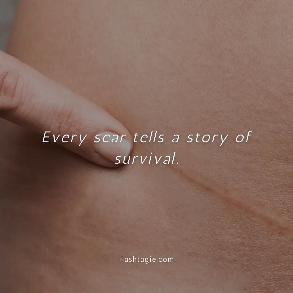 Body positive captions for photographs with scars  example image