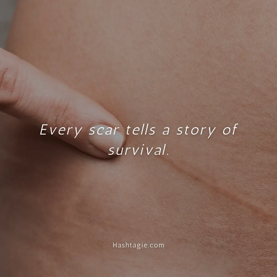 Body positive captions for photographs with scars example image