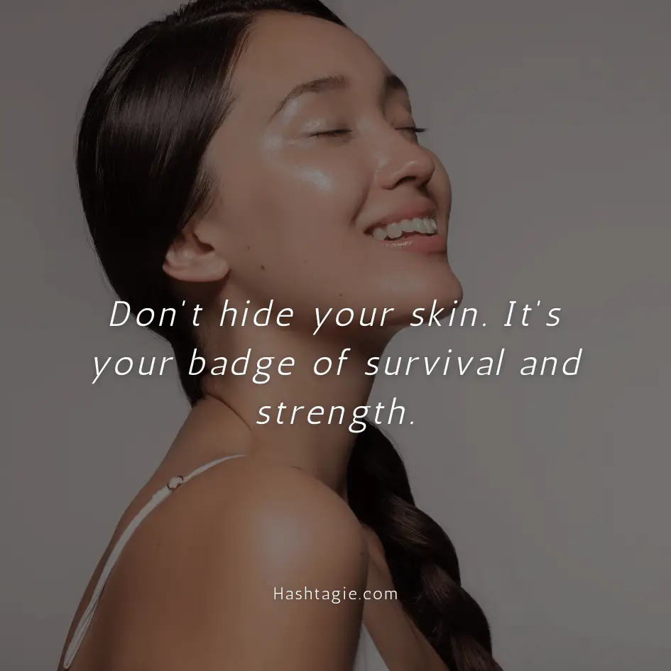 Body positive captions for skin condition acceptance example image